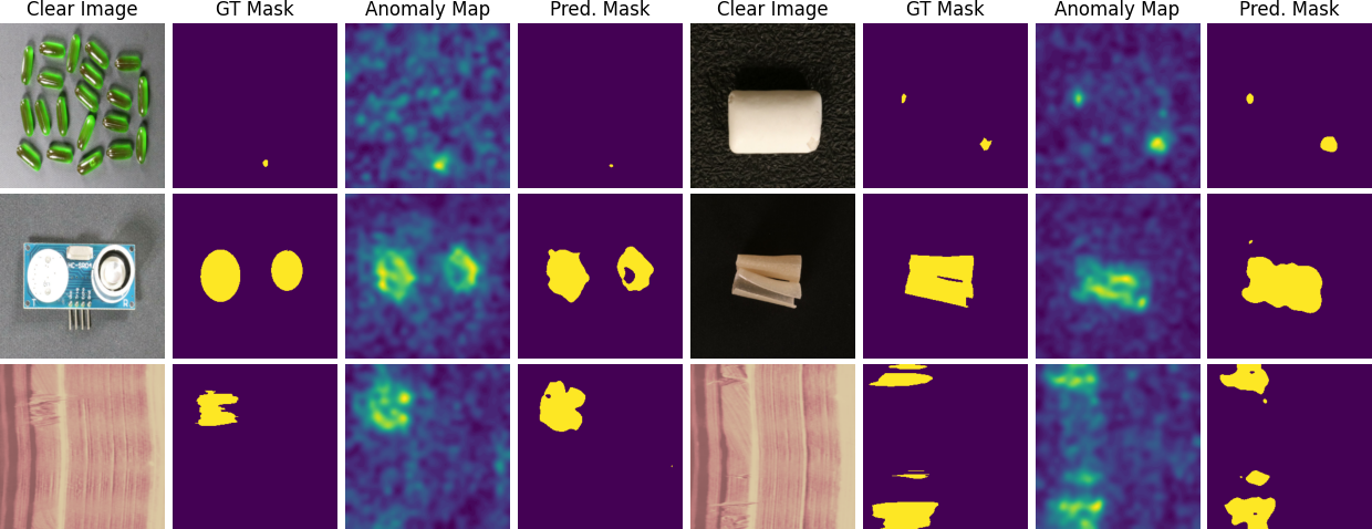 Dynamic Addition of Noise in a Diffusion Model for Anomaly Detection