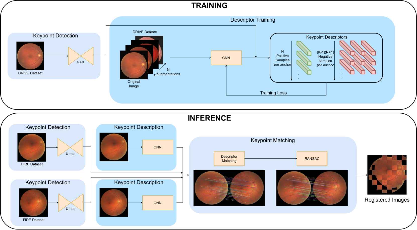 ConKeD: Multiview contrastive descriptor learning for keypoint-based retinal image registration