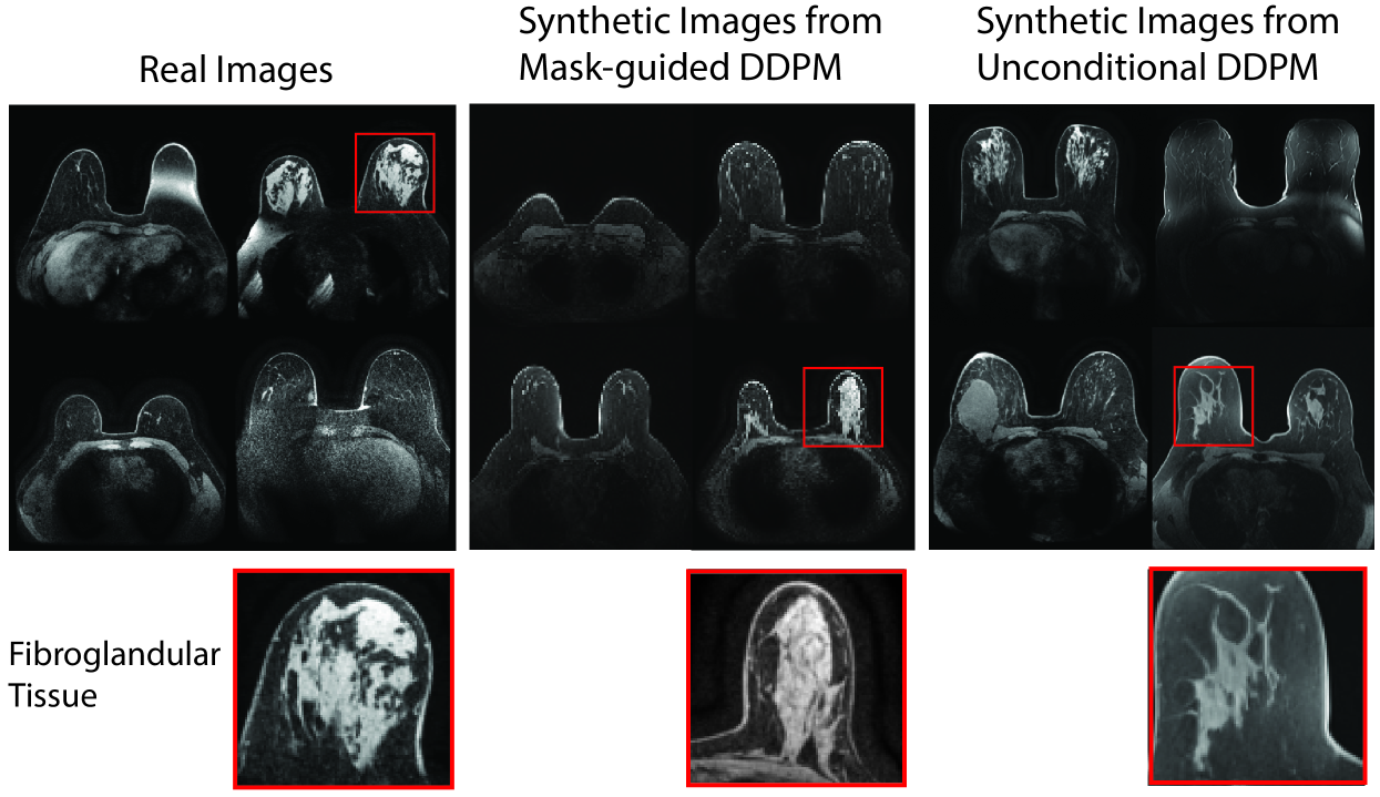 Anatomically-Controllable Medical Image Generation with Segmentation-Guided Diffusion Models