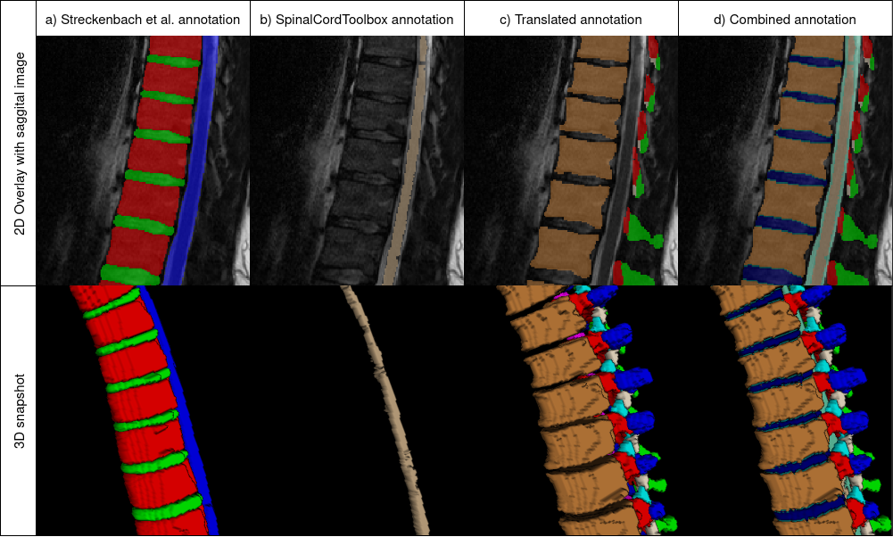 SPINEPS -- Automatic Whole Spine Segmentation of T2-weighted MR images using a Two-Phase Approach to Multi-class Semantic and Instance Segmentation