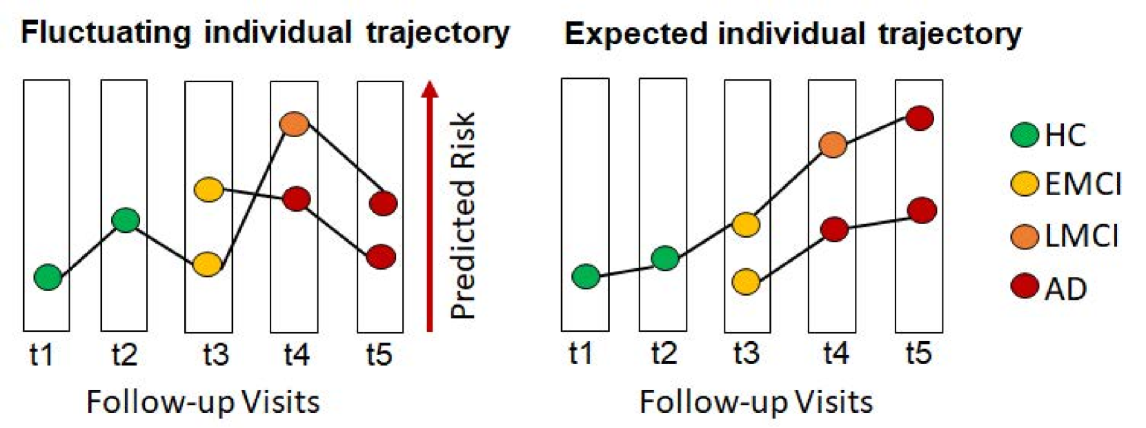 Learning the irreversible progression trajectory of Alzheimer's disease