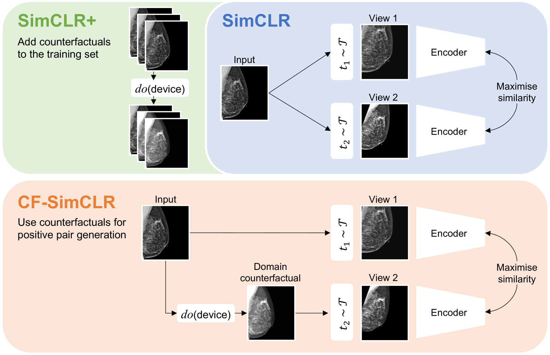 Counterfactual contrastive learning: robust representations via causal image synthesis