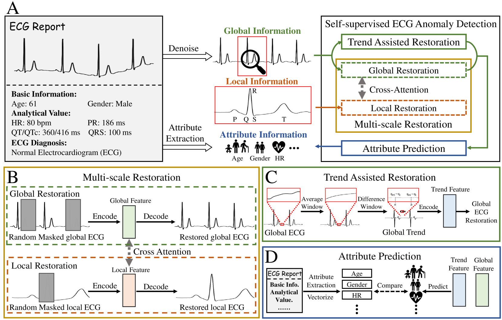 Anomaly Detection in Electrocardiograms: Advancing Clinical Diagnosis Through Self-Supervised Learning