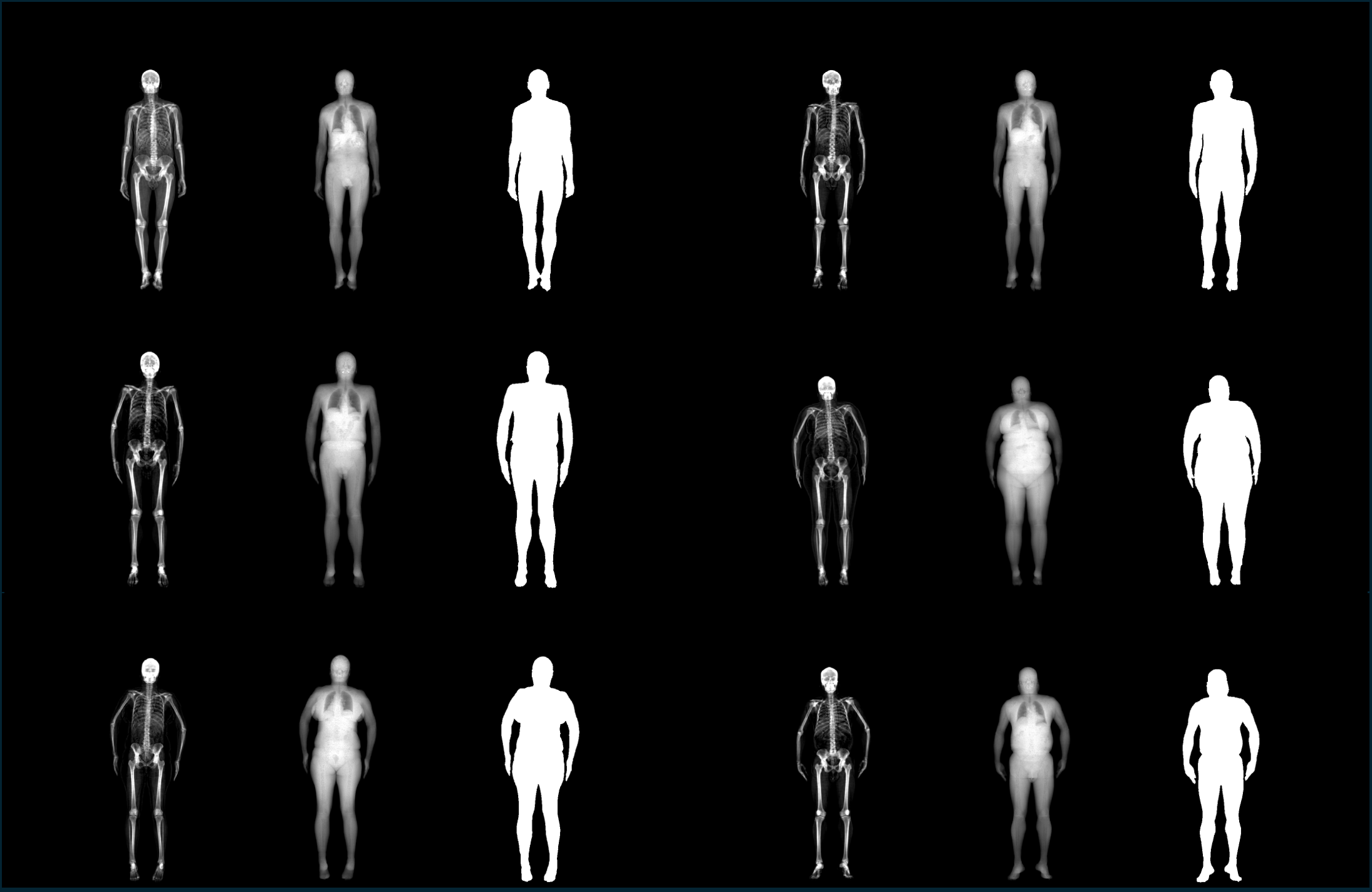 MaSkel: A Model for Human Whole-body X-rays Generation from Human Masking Images