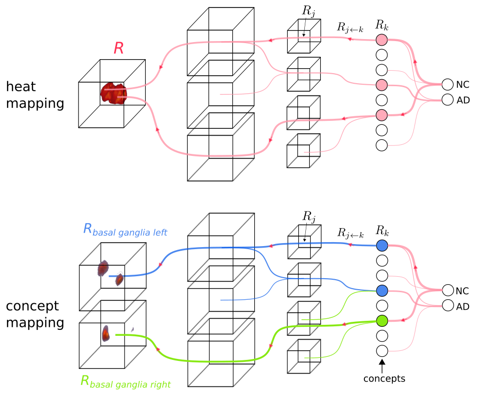 Explainable concept mappings of MRI: Revealing the mechanisms underlying deep learning-based brain disease classification