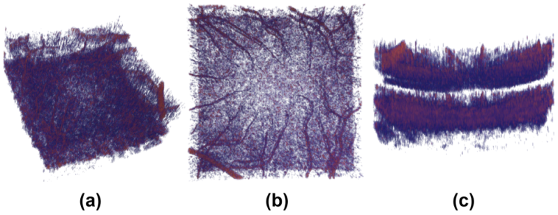 Snake with Shifted Window: Learning to Adapt Vessel Pattern for OCTA Segmentation