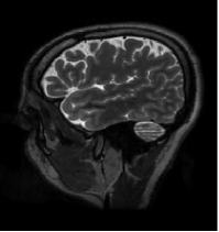 Provable Preconditioned Plug-and-Play Approach for Compressed Sensing MRI Reconstruction