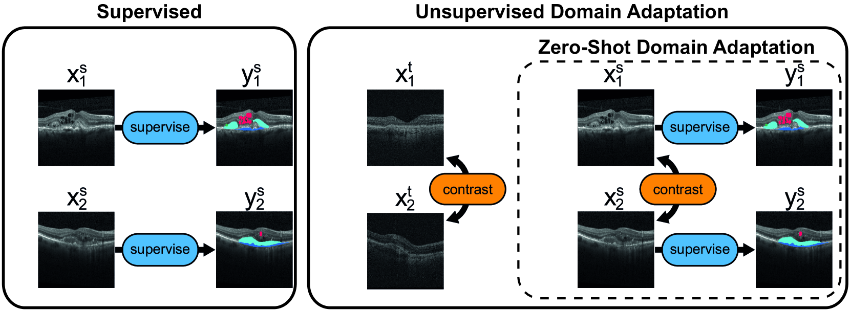 Joint semi-supervised and contrastive learning enables zero-shot domain-adaptation and multi-domain segmentation