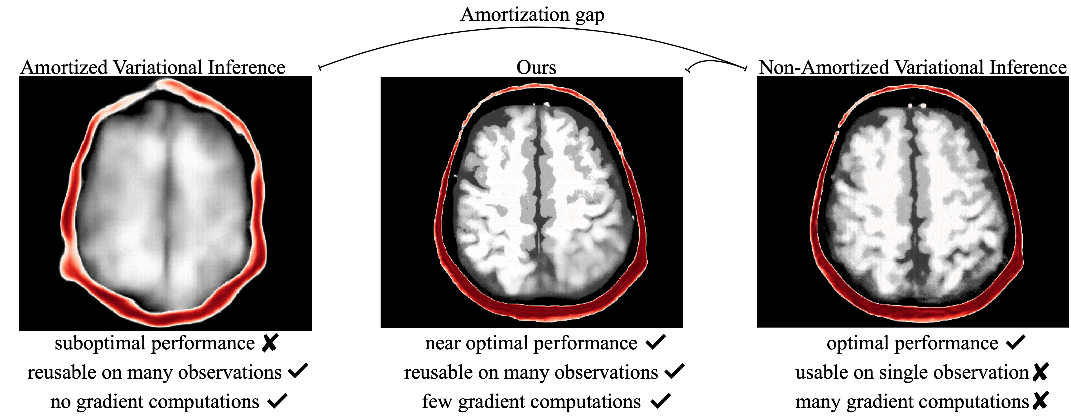 ASPIRE: Iterative Amortized Posterior Inference for Bayesian Inverse Problems