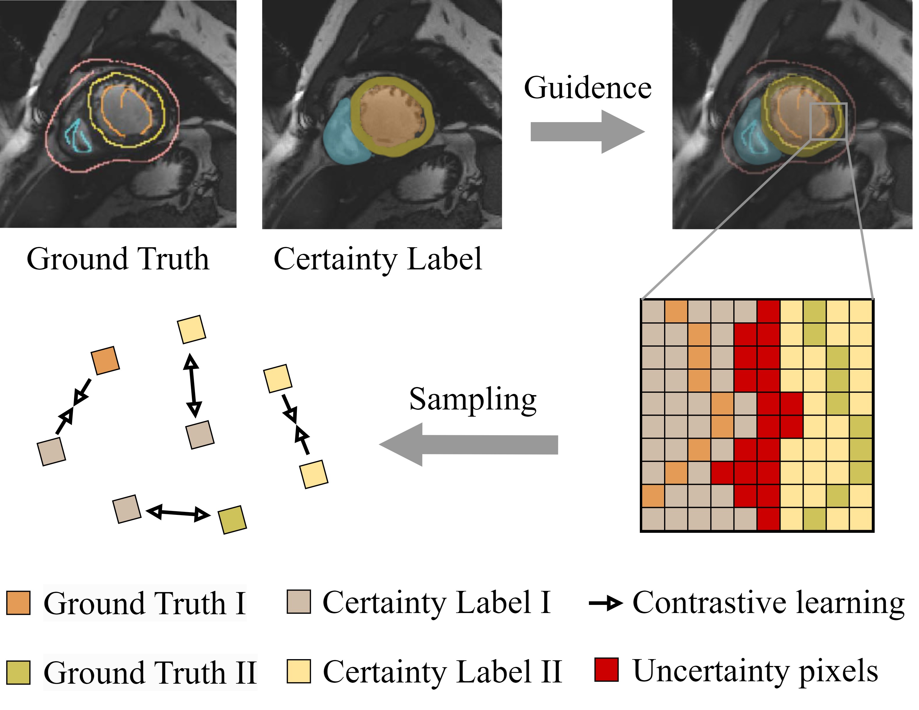 PCLMix: Weakly Supervised Medical Image Segmentation via Pixel-Level Contrastive Learning and Dynamic Mix Augmentation