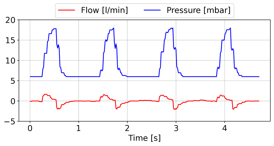 Evaluating the Explainable AI Method Grad-CAM for Breath Classification on Newborn Time Series Data