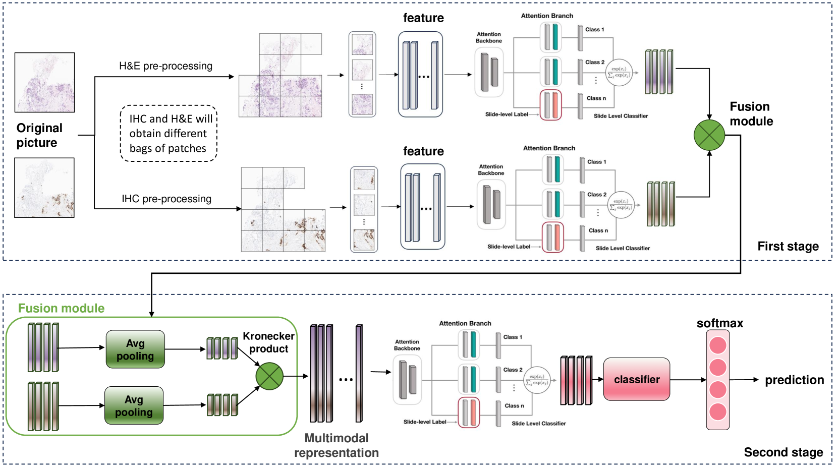 IHC Matters: Incorporating IHC analysis to H&E Whole Slide Image Analysis for Improved Cancer Grading via Two-stage Multimodal Bilinear Pooling Fusion