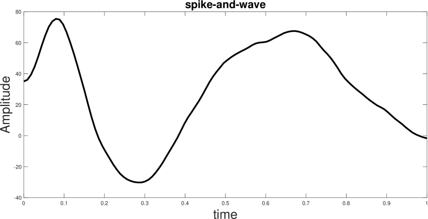 Study on spike-and-wave detection in epileptic signals using t-location-scale distribution and the K-nearest neighbors classifier