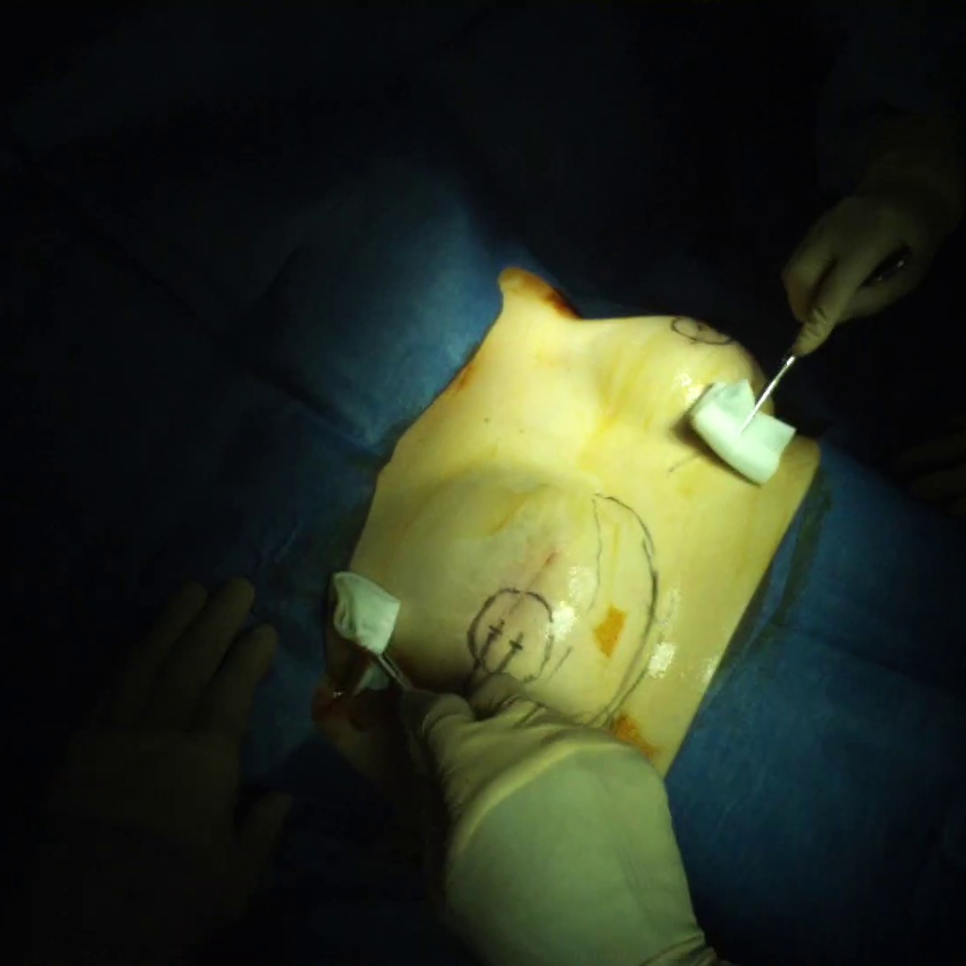 EgoSurgery-Phase: A Dataset of Surgical Phase Recognition from Egocentric Open Surgery Videos