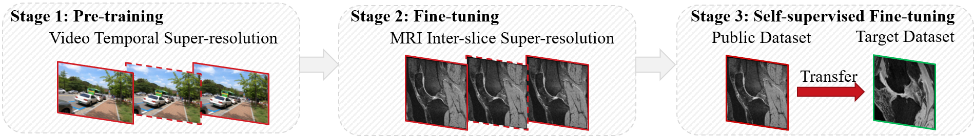 Inter-slice Super-resolution of Magnetic Resonance Images by Pre-training and Self-supervised Fine-tuning