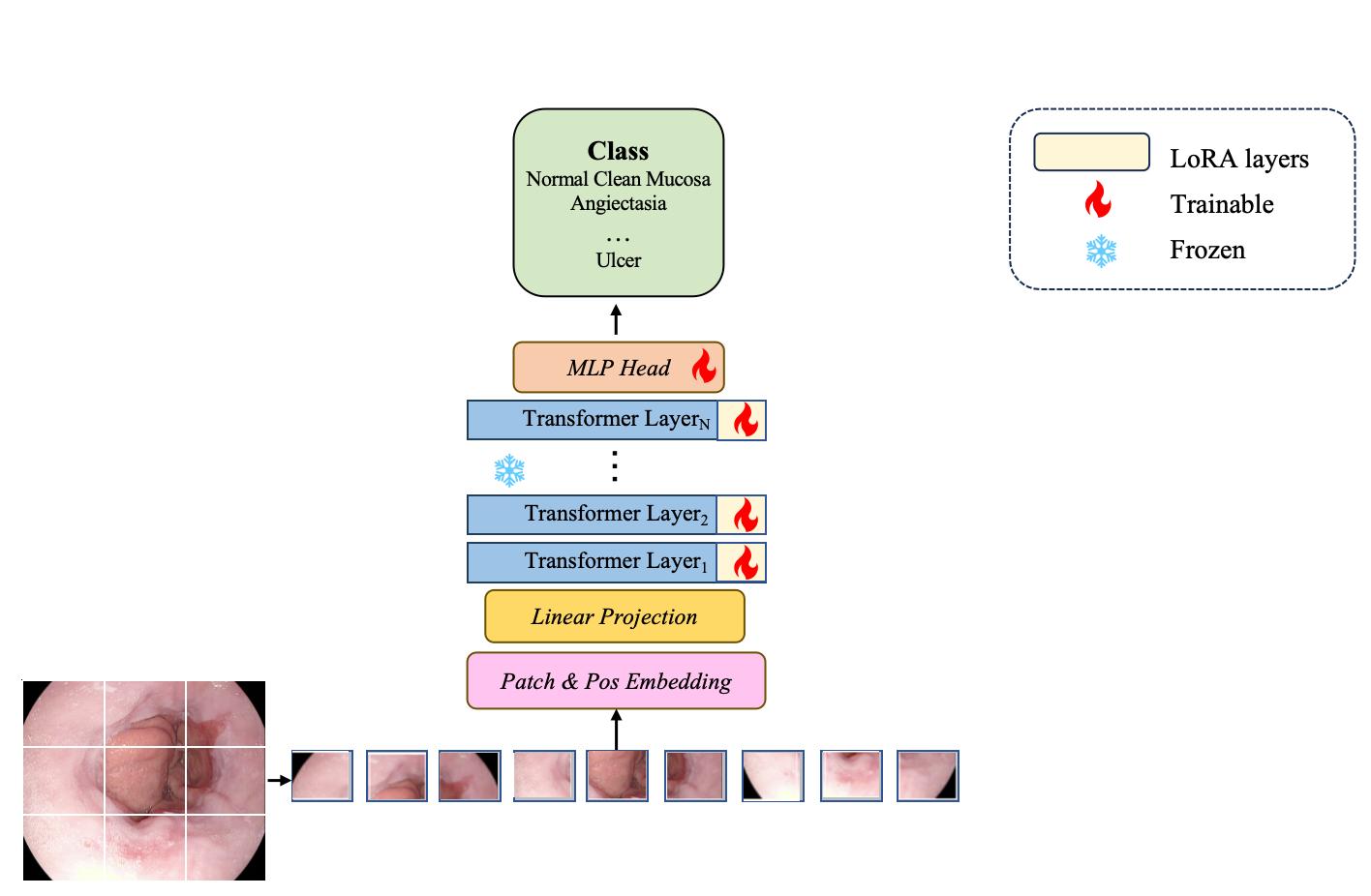 Learning to Adapt Foundation Model DINOv2 for Capsule Endoscopy Diagnosis