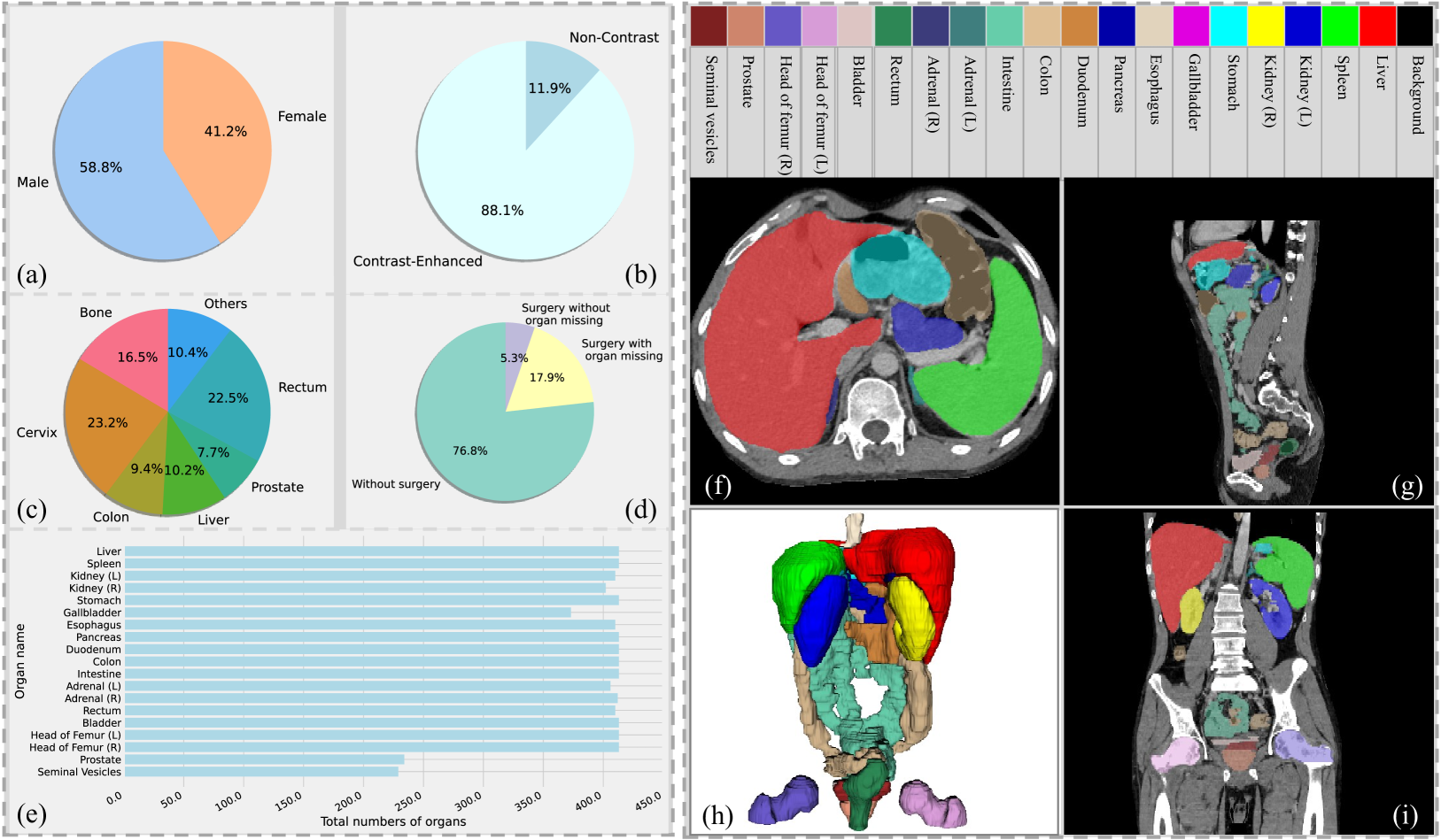 Rethinking Abdominal Organ Segmentation (RAOS) in the clinical scenario: A robustness evaluation benchmark with challenging cases