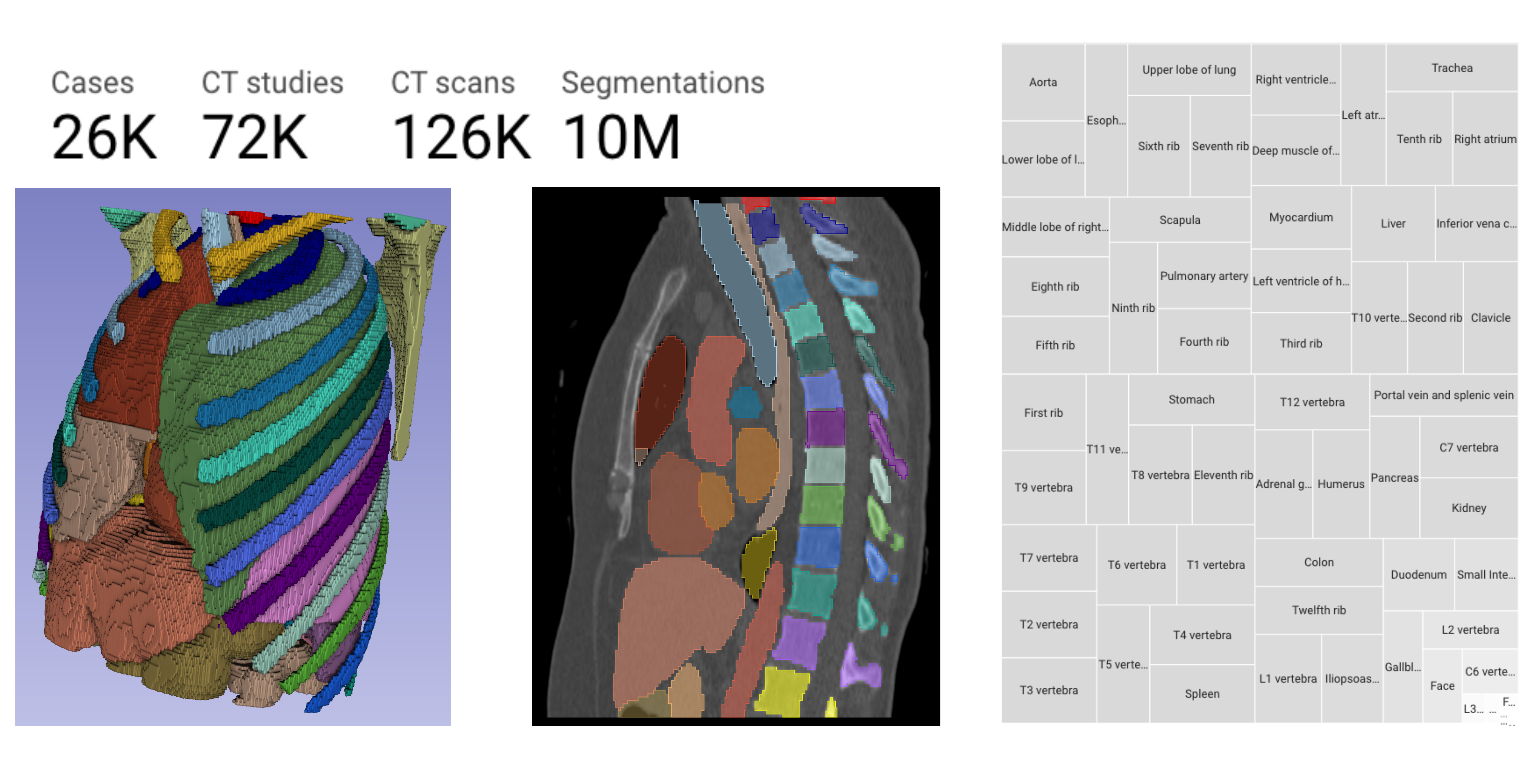 Rule-based outlier detection of AI-generated anatomy segmentations