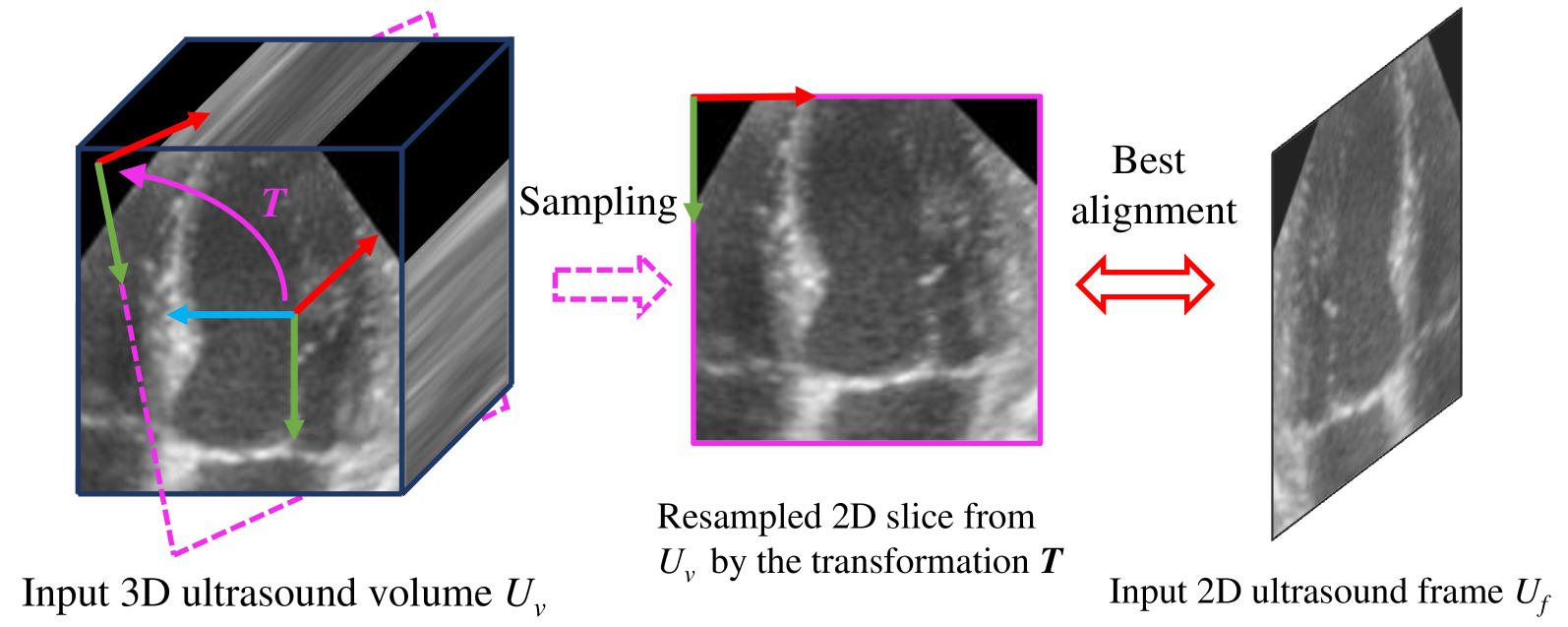 Epicardium Prompt-guided Real-time Cardiac Ultrasound Frame-to-volume Registration