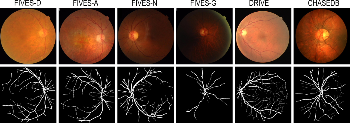 Benchmarking Retinal Blood Vessel Segmentation Models for Cross-Dataset and Cross-Disease Generalization