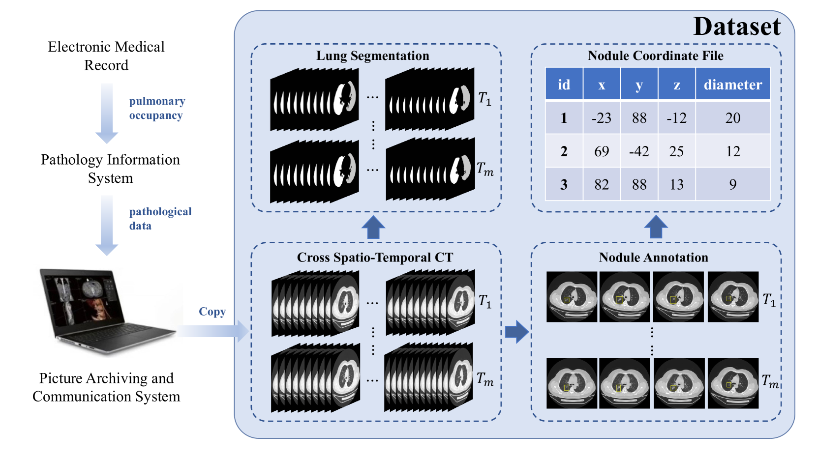 A Cross Spatio-Temporal Pathology-based Lung Nodule Dataset