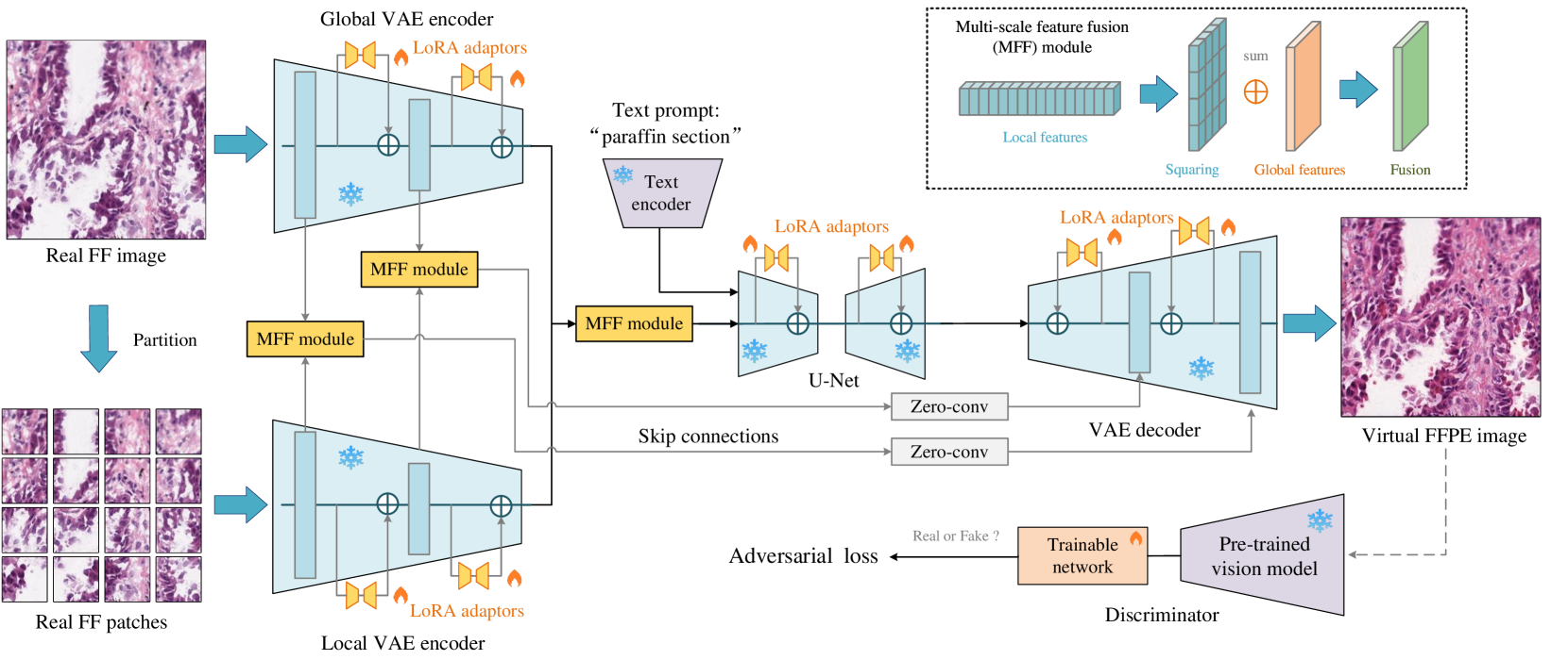 Leveraging Pre-trained Models for FF-to-FFPE Histopathological Image Translation