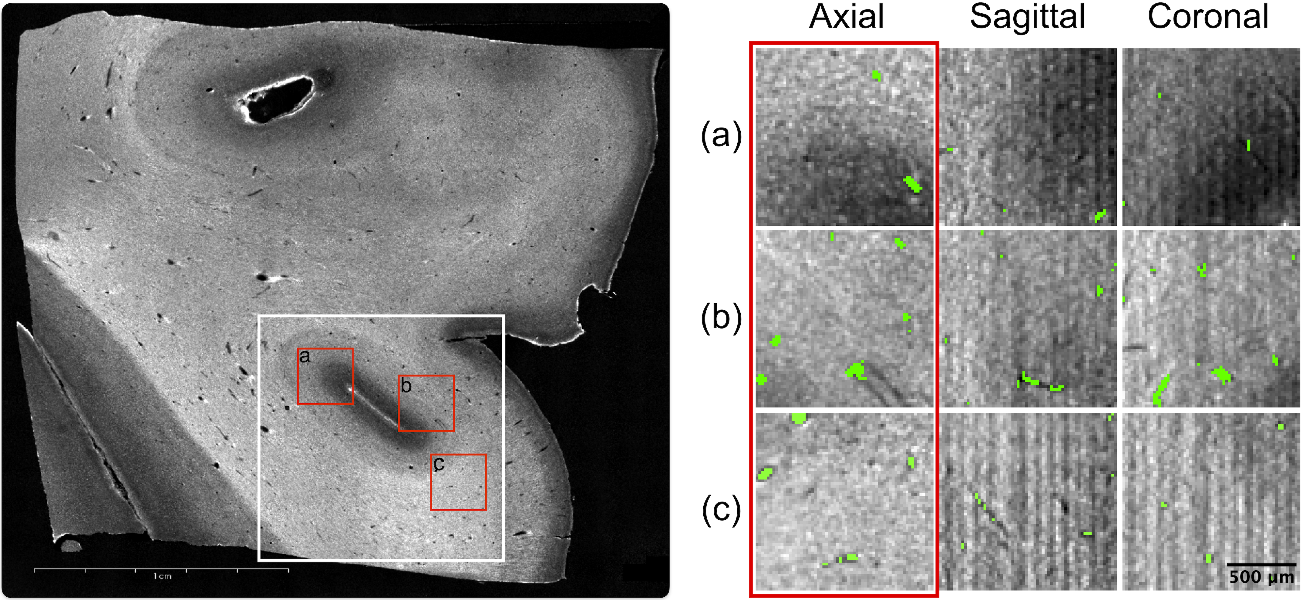 Neurovascular Segmentation in sOCT with Deep Learning and Synthetic Training Data