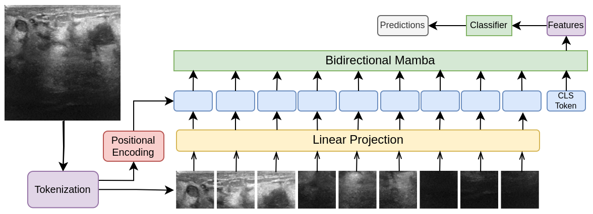 Vision Mamba for Classification of Breast Ultrasound Images