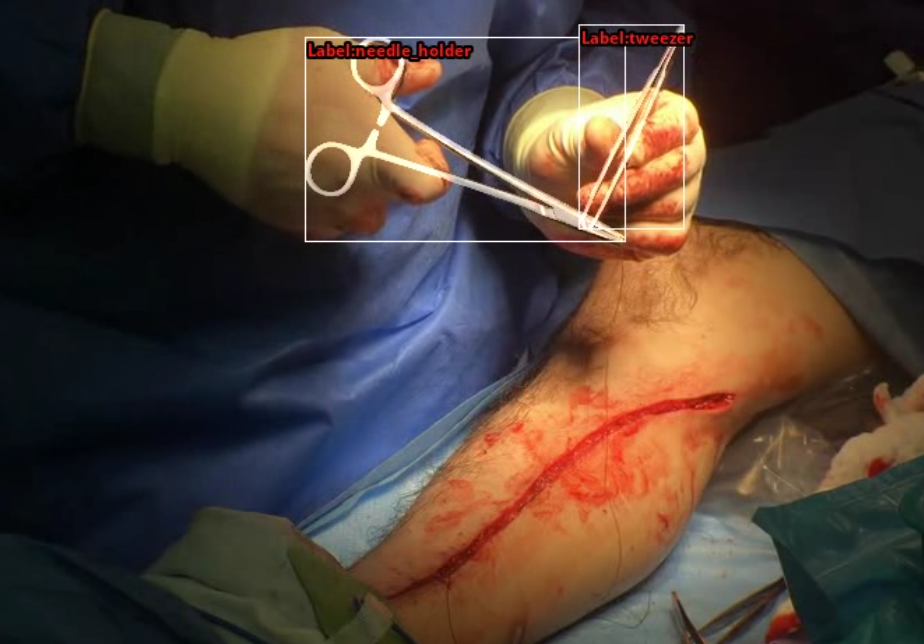 Monocular pose estimation of articulated surgical instruments in open surgery