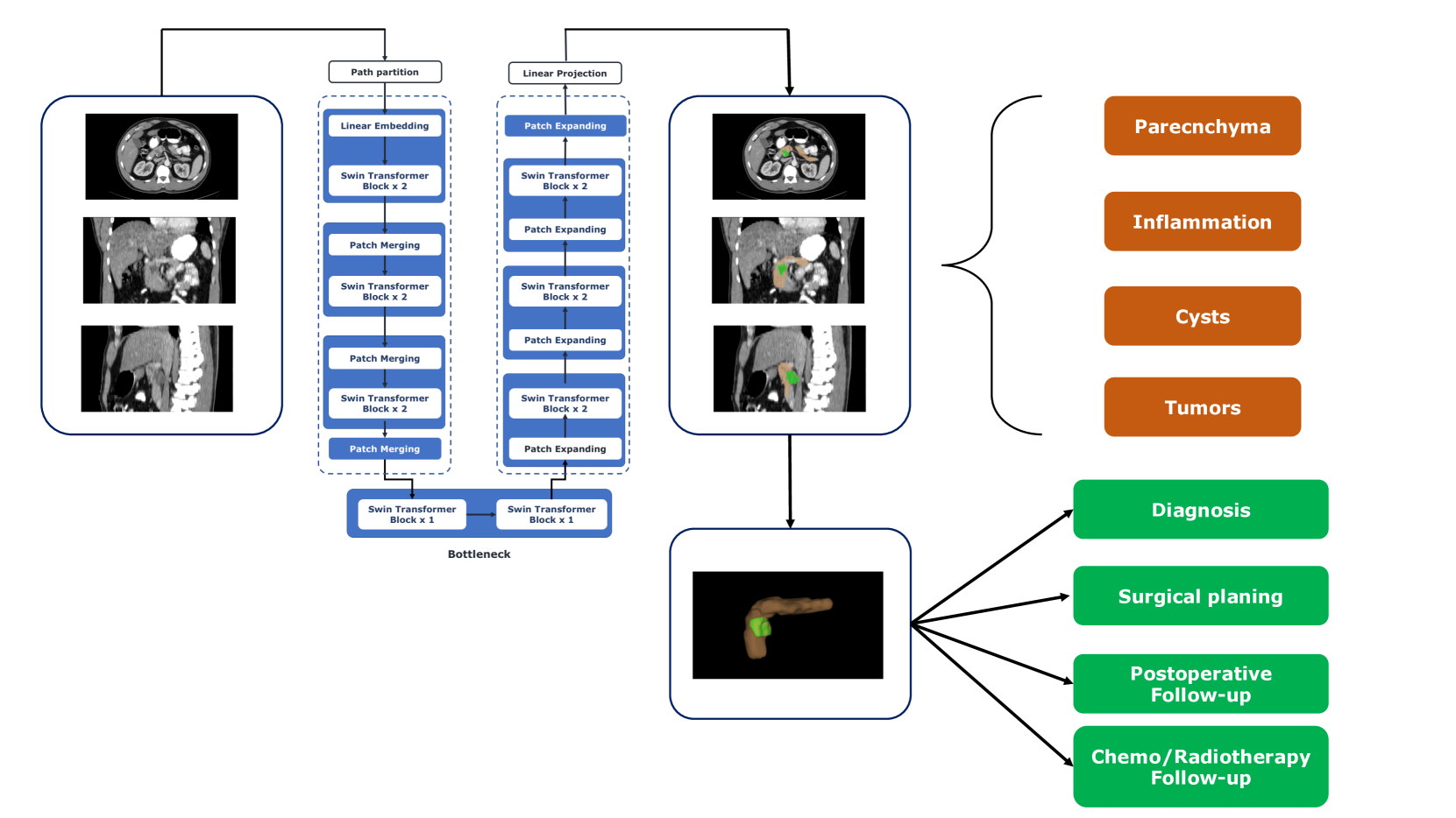 Deep Learning for Pancreas Segmentation: a Systematic Review