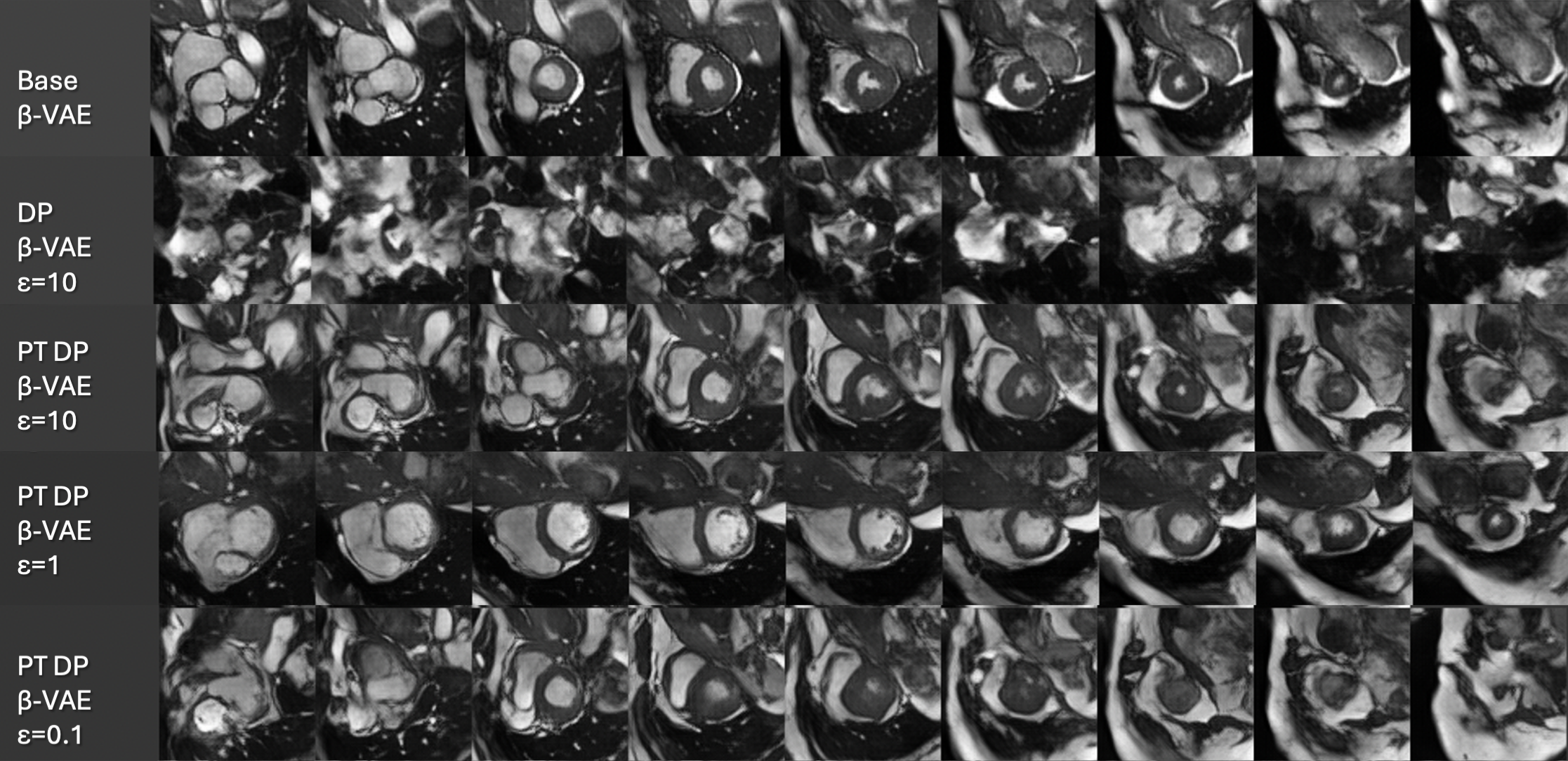 On Differentially Private 3D Medical Image Synthesis with Controllable Latent Diffusion Models