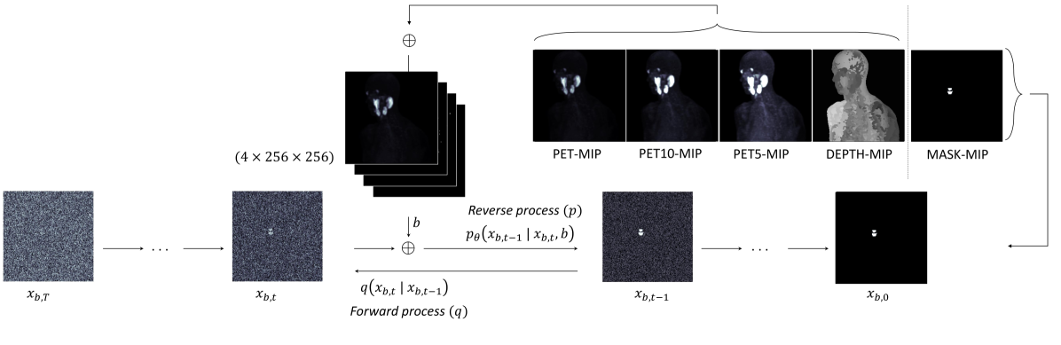 How To Segment in 3D Using 2D Models: Automated 3D Segmentation of Prostate Cancer Metastatic Lesions on PET Volumes Using Multi-Angle Maximum Intensity Projections and Diffusion Models