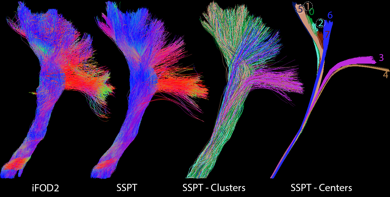 Multi-dimensional Parameter Space Exploration for Streamline-specific Tractography