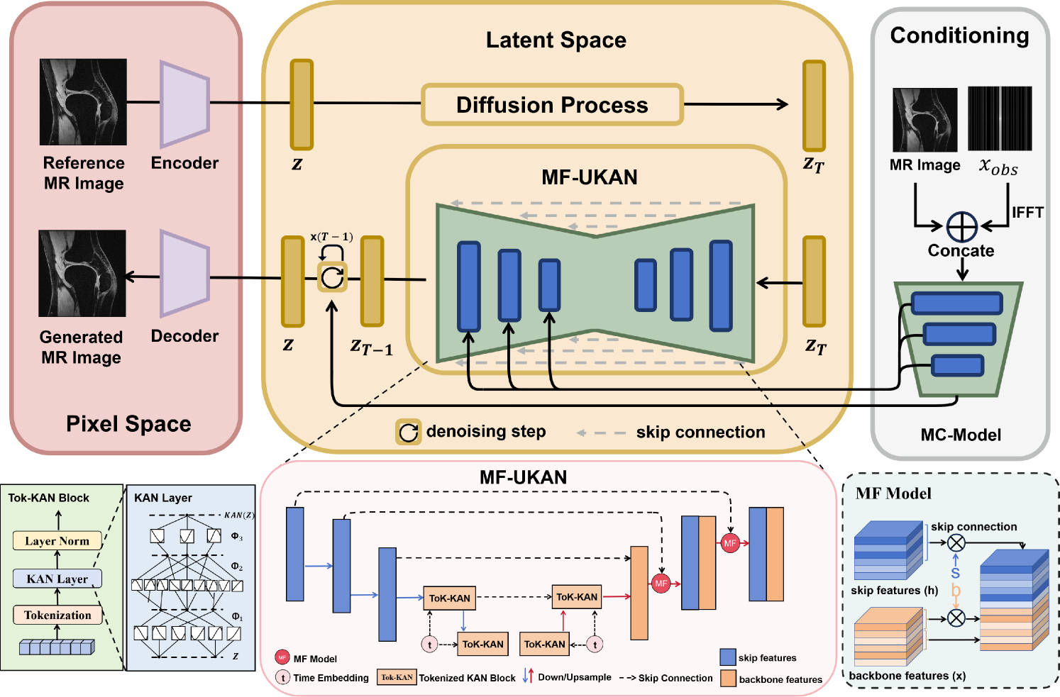 TC-KANRecon: High-Quality and Accelerated MRI Reconstruction via Adaptive KAN Mechanisms and Intelligent Feature Scaling