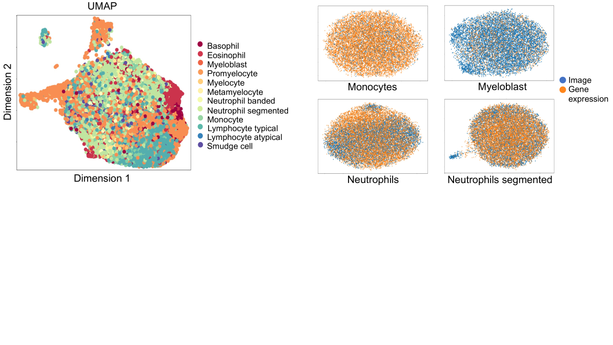 Multimodal Analysis of White Blood Cell Differentiation in Acute Myeloid Leukemia Patients using a beta-Variational Autoencoder