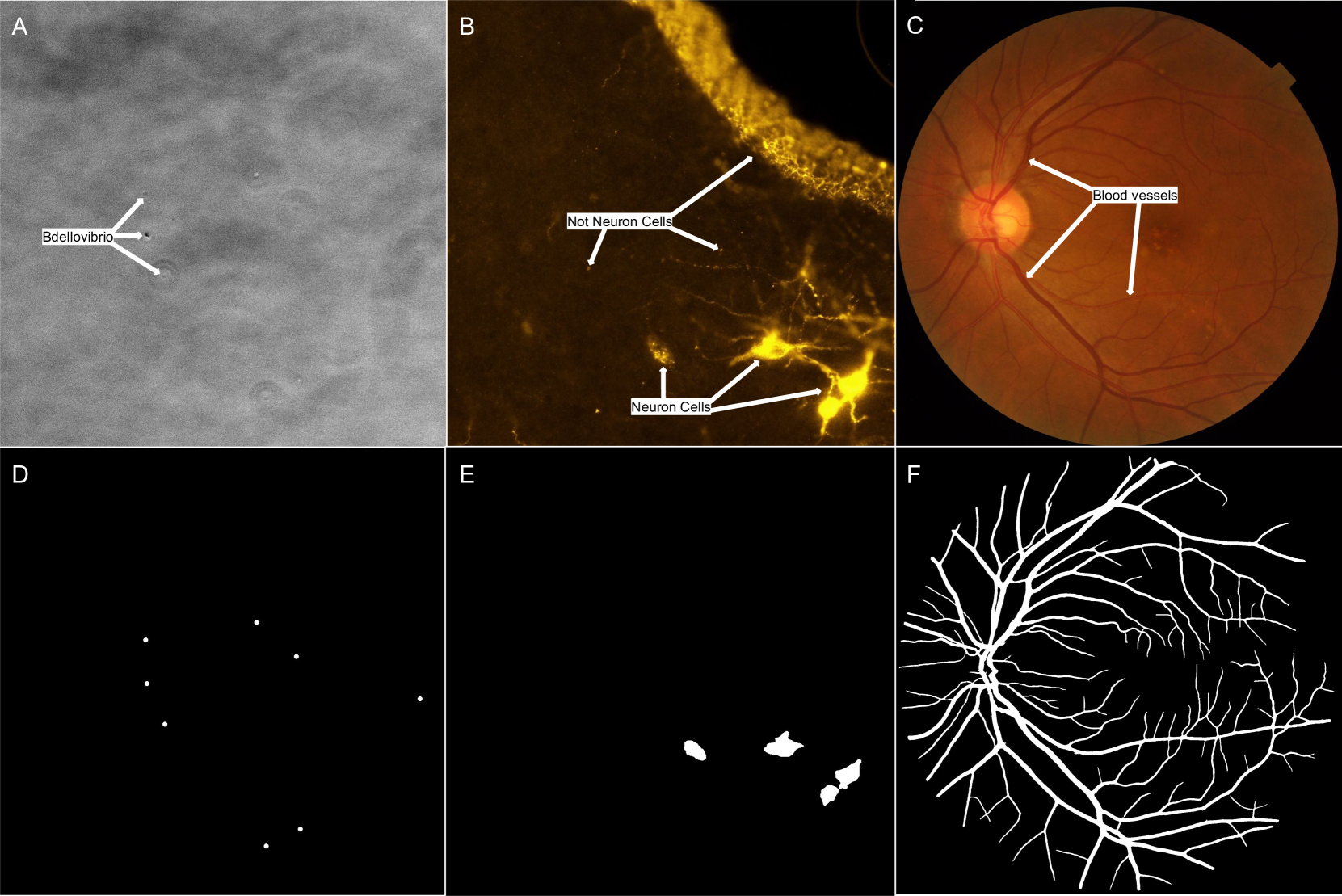 Perspectives: Comparison of Deep Learning Segmentation Models on Biophysical and Biomedical Data