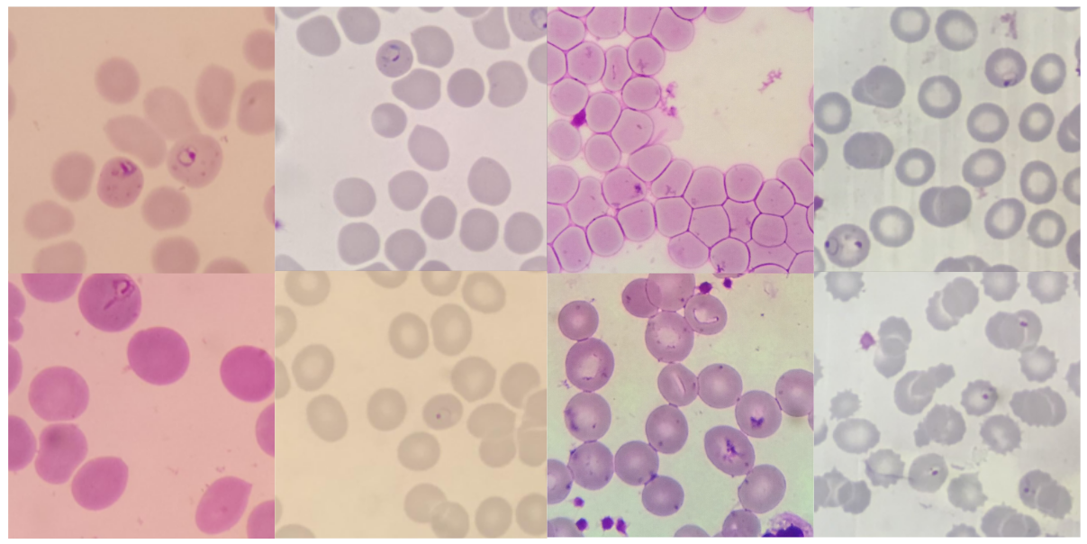 Assessing Generalization Capabilities of Malaria Diagnostic Models from Thin Blood Smears