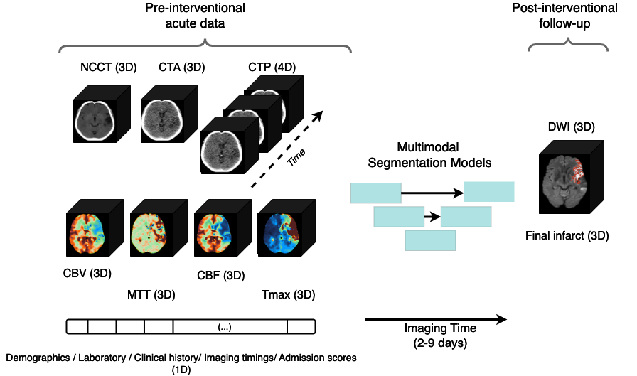 ISLES'24: Improving final infarct prediction in ischemic stroke using multimodal imaging and clinical data