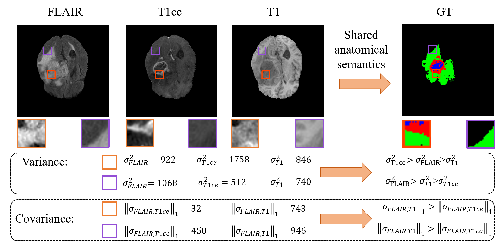 Anatomical Consistency Distillation and Inconsistency Synthesis for Brain Tumor Segmentation with Missing Modalities