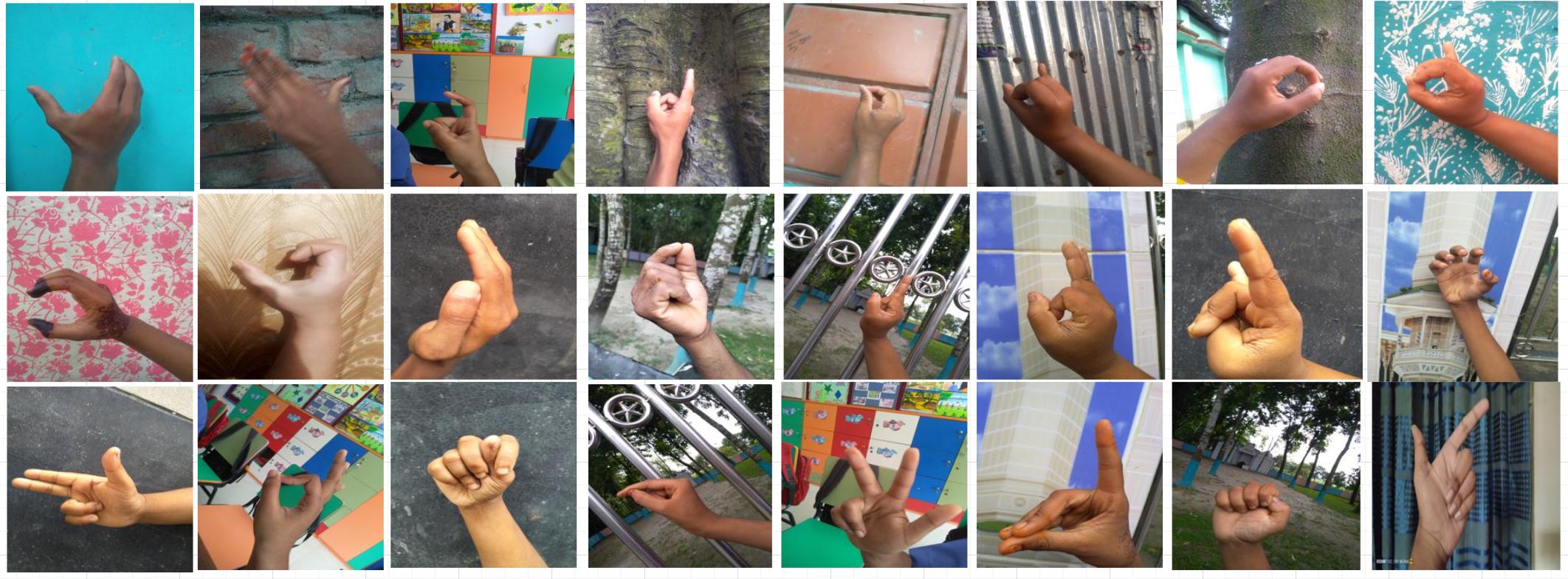 Bengali Sign Language Recognition through Hand Pose Estimation using Multi-Branch Spatial-Temporal Attention Model