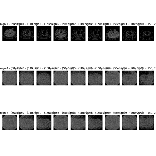 Optimizing Lung Cancer Detection in CT Imaging: A Wavelet Multi-Layer Perceptron (WMLP) Approach Enhanced by Dragonfly Algorithm (DA)