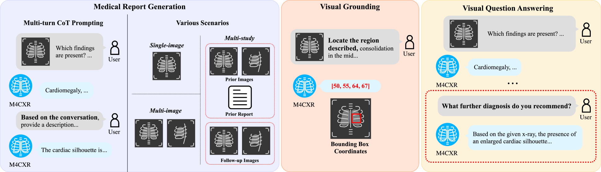 M4CXR: Exploring Multi-task Potentials of Multi-modal Large Language Models for Chest X-ray Interpretation