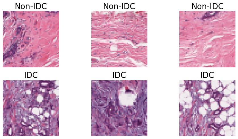 Comparative Analysis of Transfer Learning Models for Breast Cancer Classification