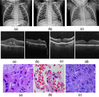 Disease Classification and Impact of Pretrained Deep Convolution Neural Networks on Diverse Medical Imaging Datasets across Imaging Modalities