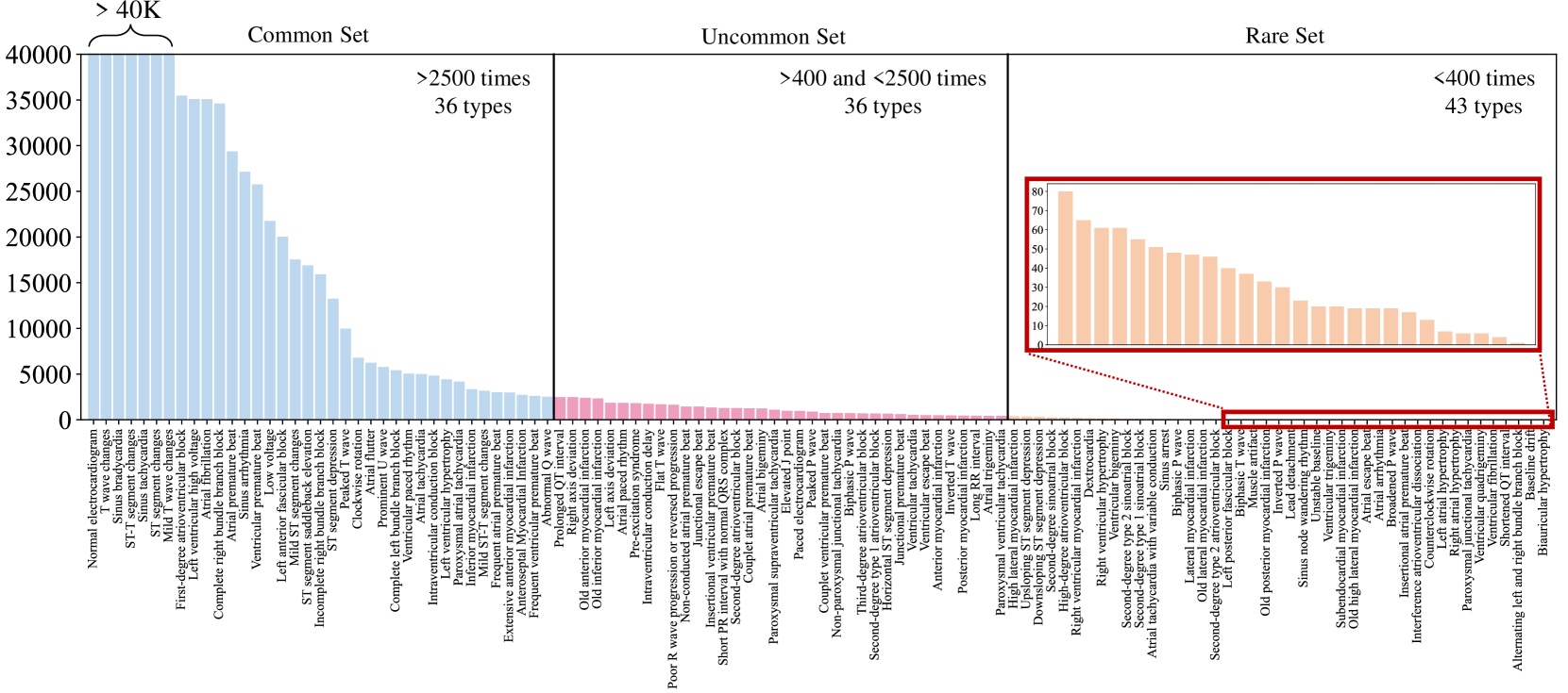 Self-supervised Anomaly Detection Pretraining Enhances Long-tail ECG Diagnosis