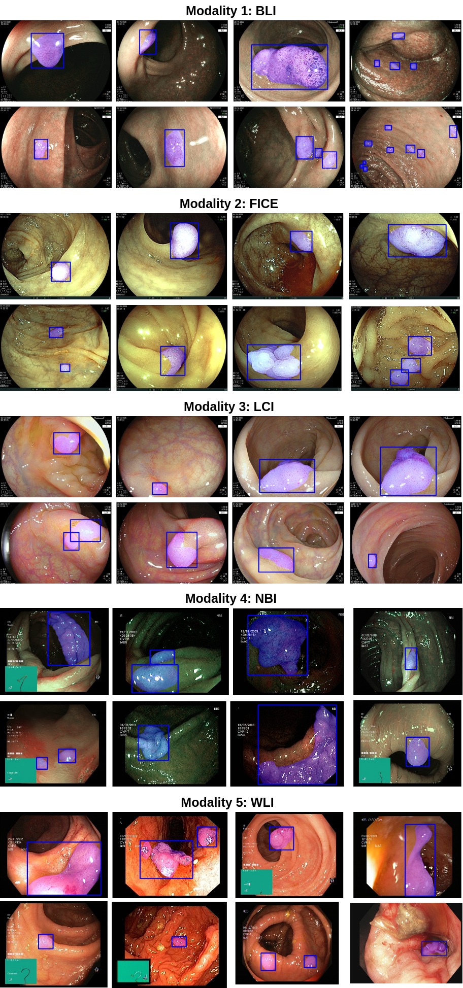 PolypDB: A Curated Multi-Center Dataset for Development of AI Algorithms in Colonoscopy