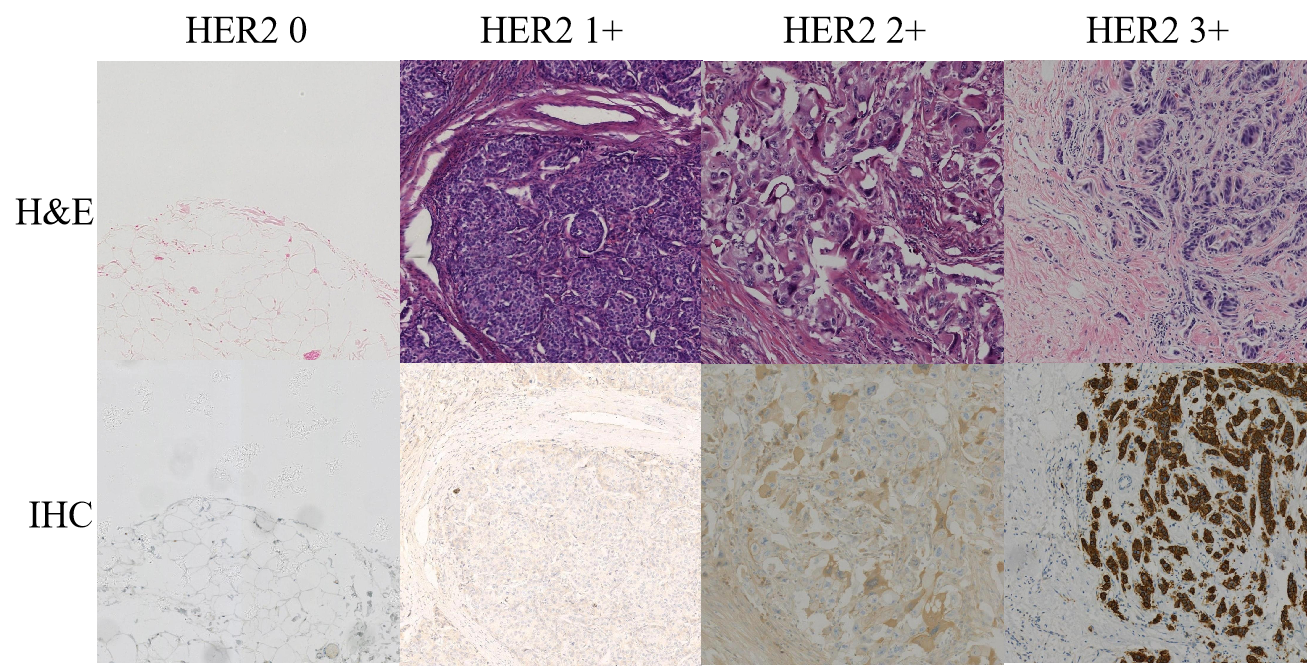 DeReStainer: H&E to IHC Pathological Image Translation via Decoupled Staining Channels