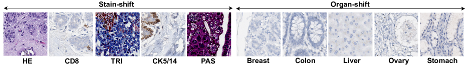 Continual Domain Incremental Learning for Privacy-aware Digital Pathology