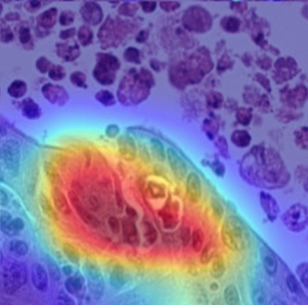 Refer to caption