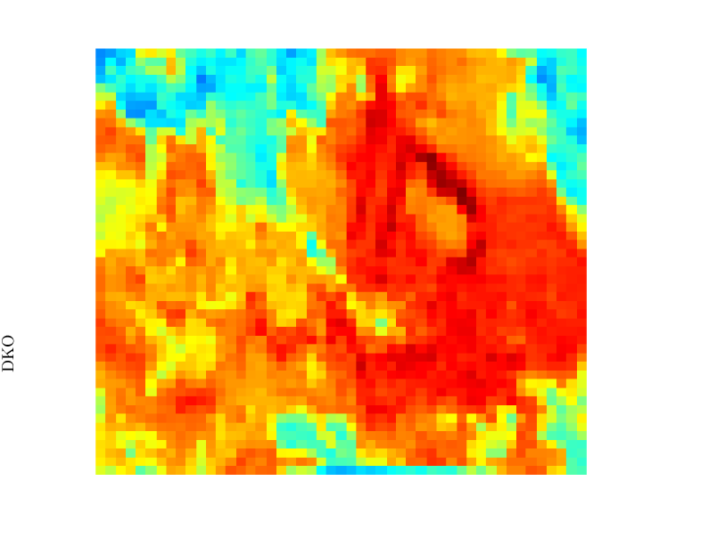 \begin{overpic}[width=433.62pt]{figures/DUST1_predict.eps}
\put(0.0,23.0){\rotatebox{90.0}{DKO}}
\end{overpic}